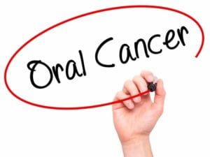 Oral-Cancer-OMS-768x576
