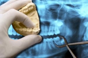 Tooth-Extraction-Nashville-768x510